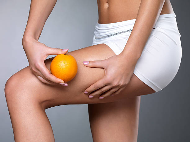 Female squeezes cellulite skin on her legs - close-up shot on white background
